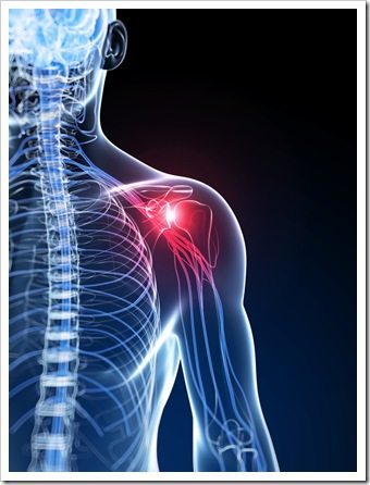 Shoulder Pain Ventura CA Rotator Cuff Syndrome