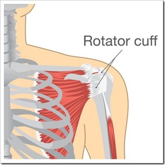 Shoulder Pain Ventura CA Rotator Cuff Injury